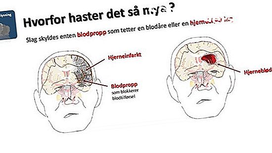 Tegn og symptomer på mold i en ovn
