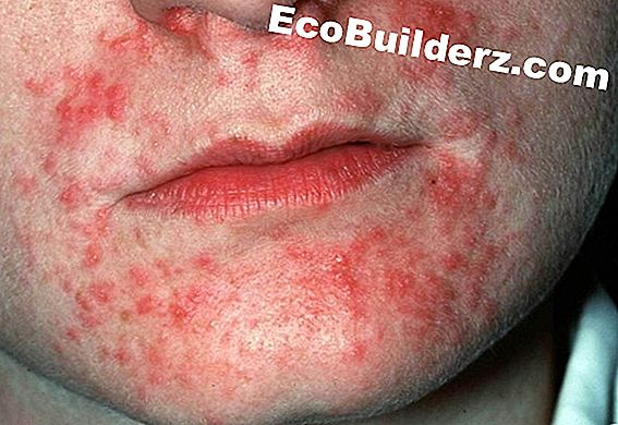 Hoe: Peroxide in de Hot Tub